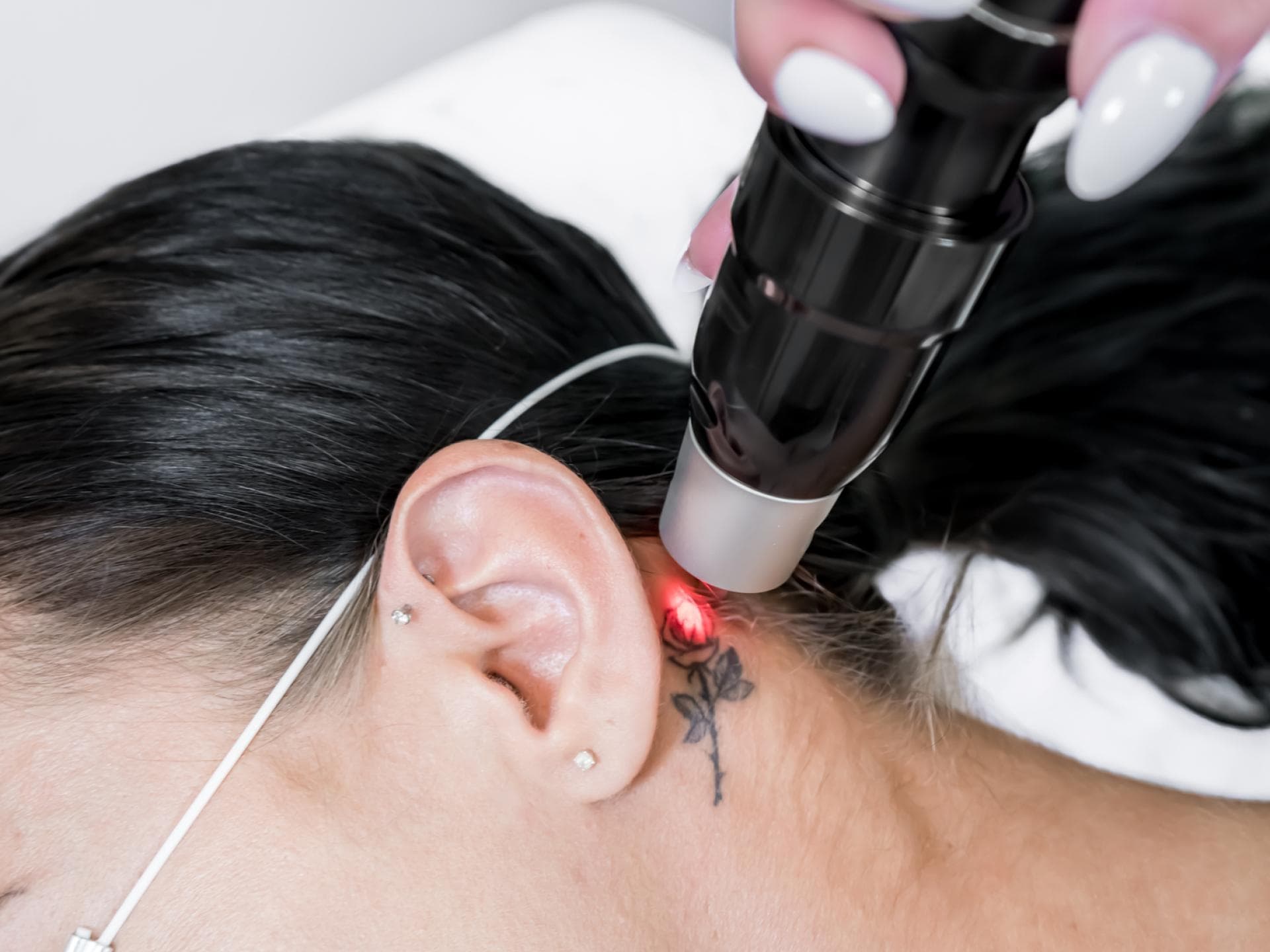 Tatto hinter dem Ohr wird gelasert