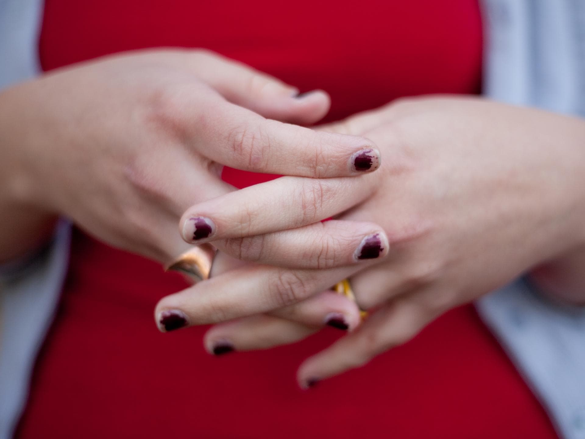 Abgesplitterter Nagellack