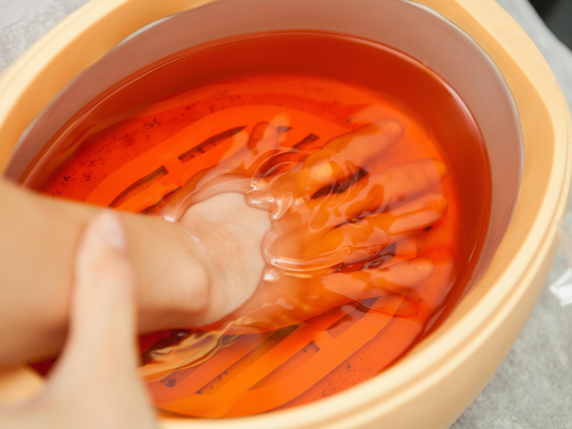 Hand in Paraffinbad