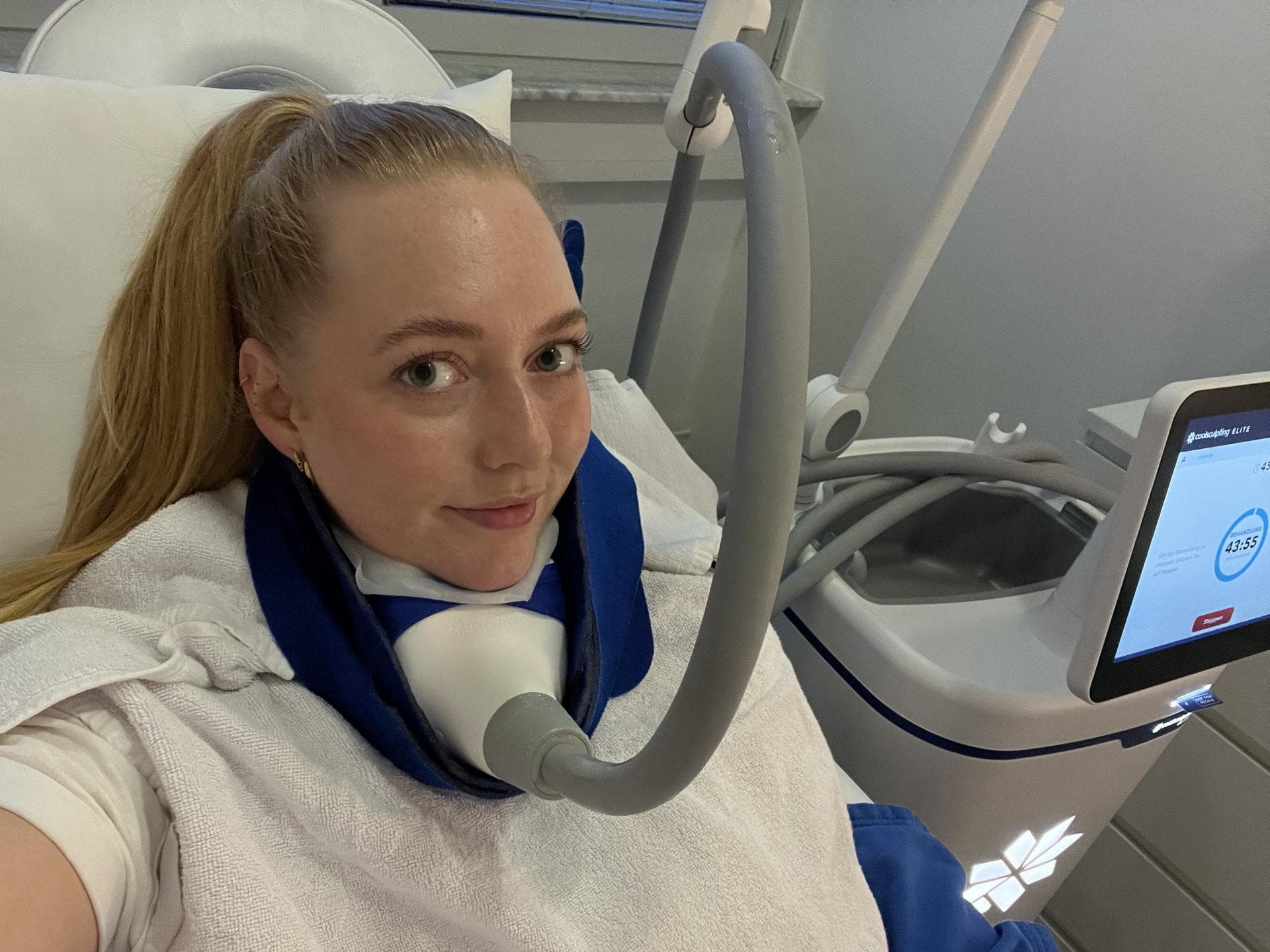 CoolSculpting am Doppelkinn