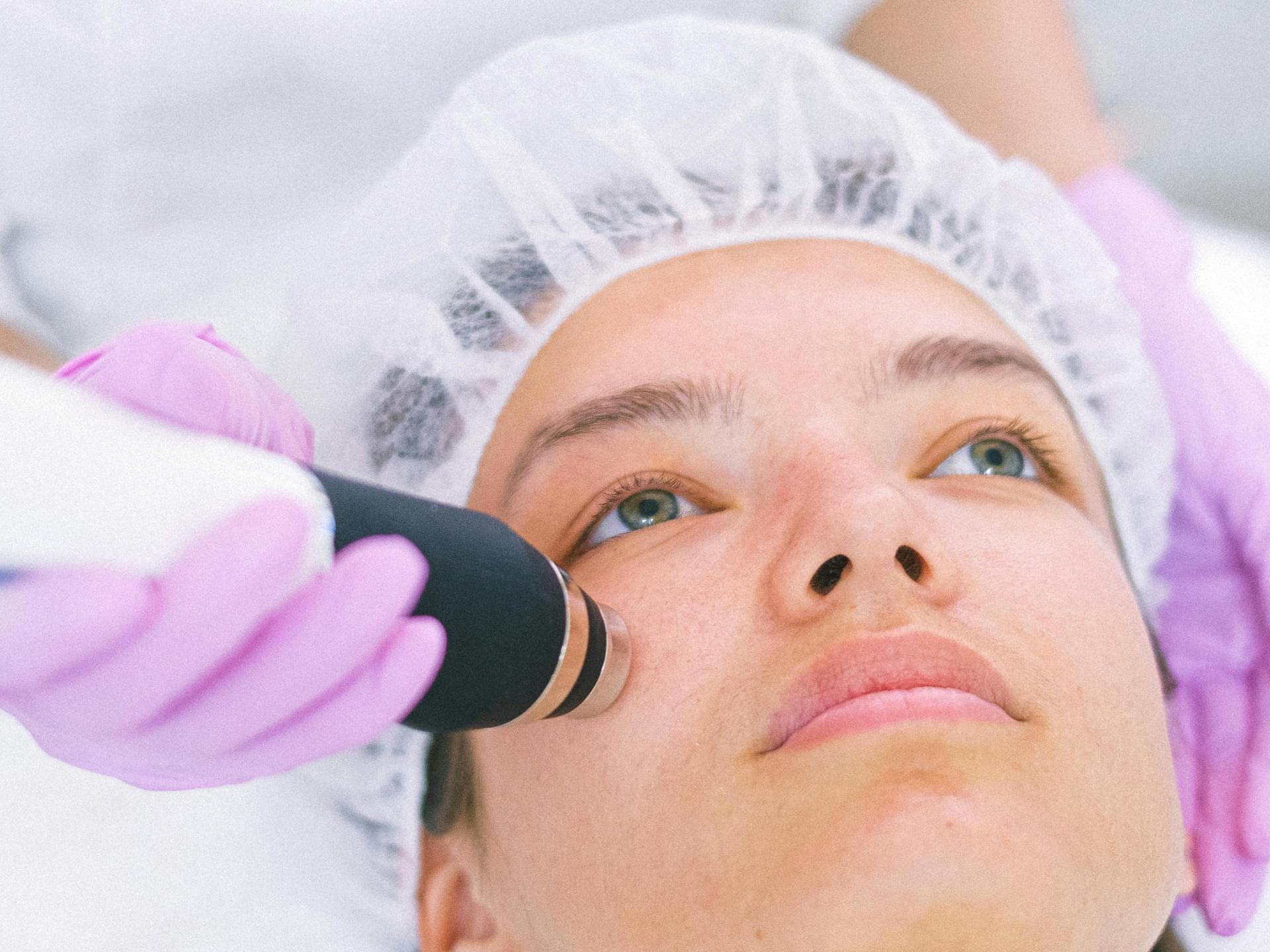 Hydradermabrasion Anwendung der Hydradermabrasion Gesichtsbehandlung