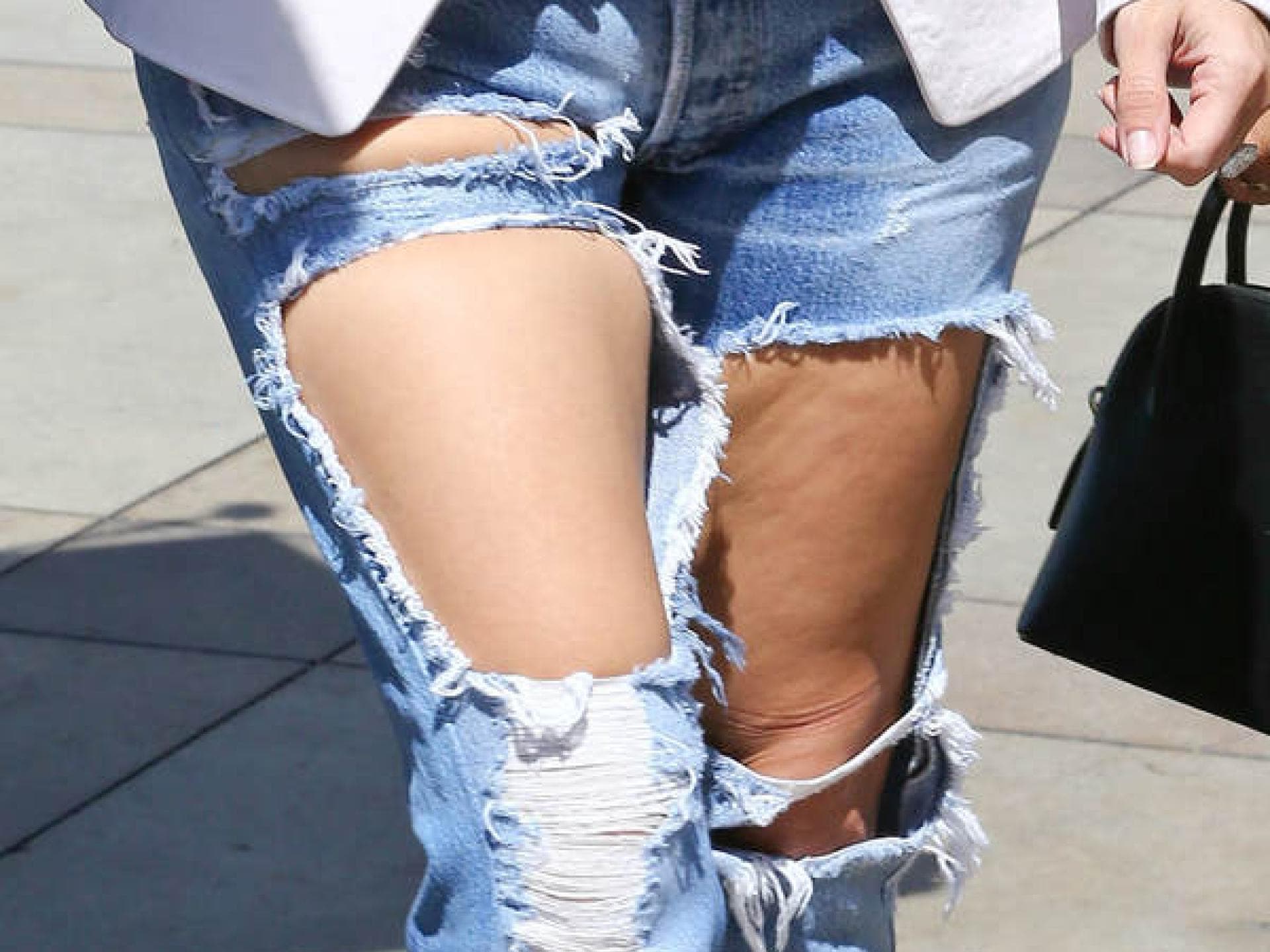 Stars mit Cellulite