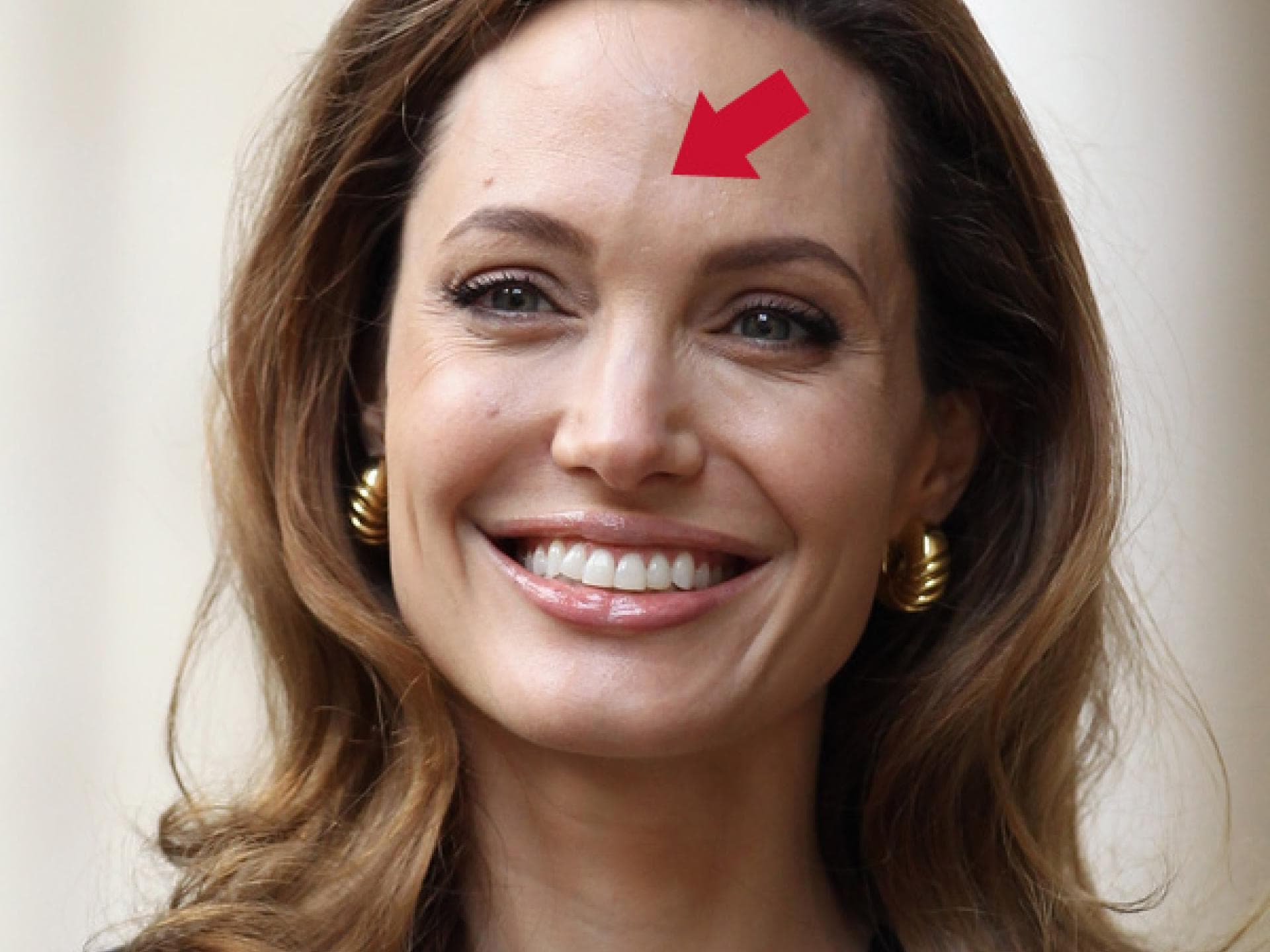 Angelina Jolies Stirn Vene Angelina Jolies Stirn Vene