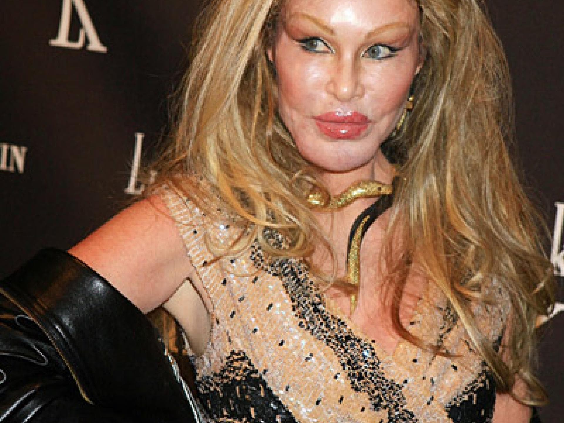 Schönheits-OPs: Jocelyn Wildenstein, die Katzenfrau