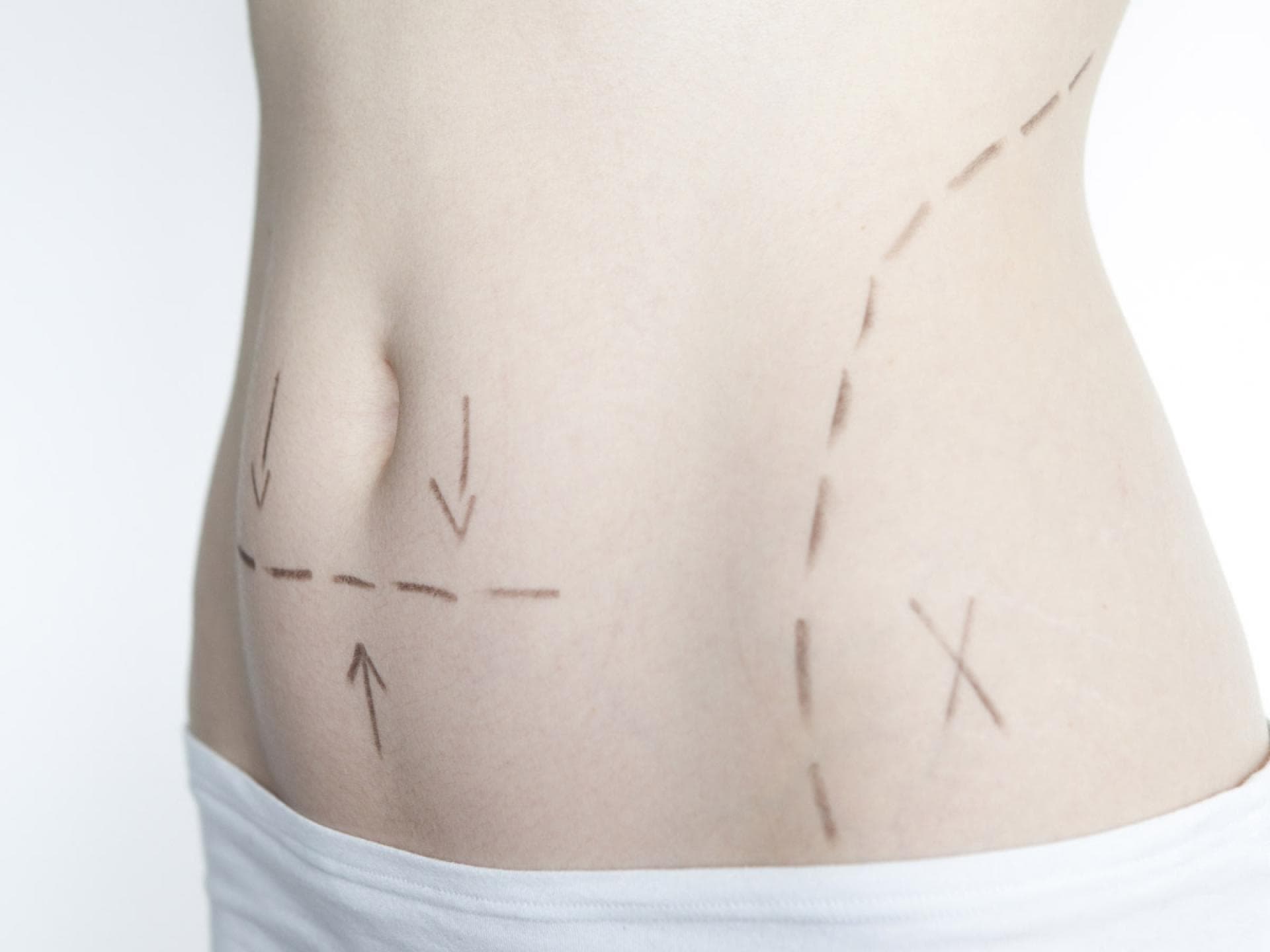 Schönheitsoperation_Thinkstock_1200x900