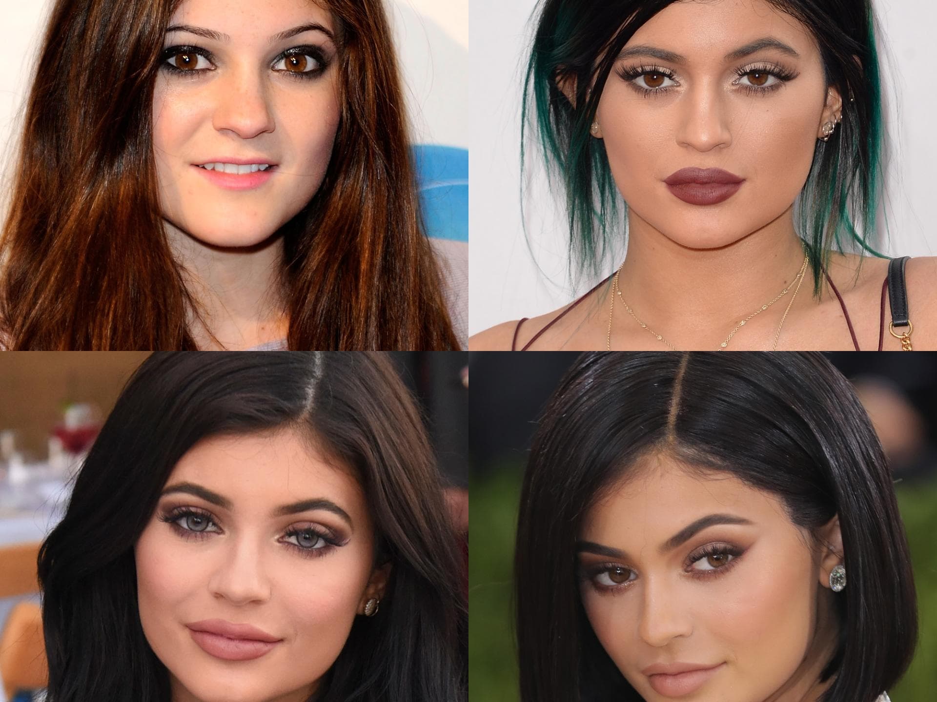 kylie-jenner-lippen kylie-jenner-lippen