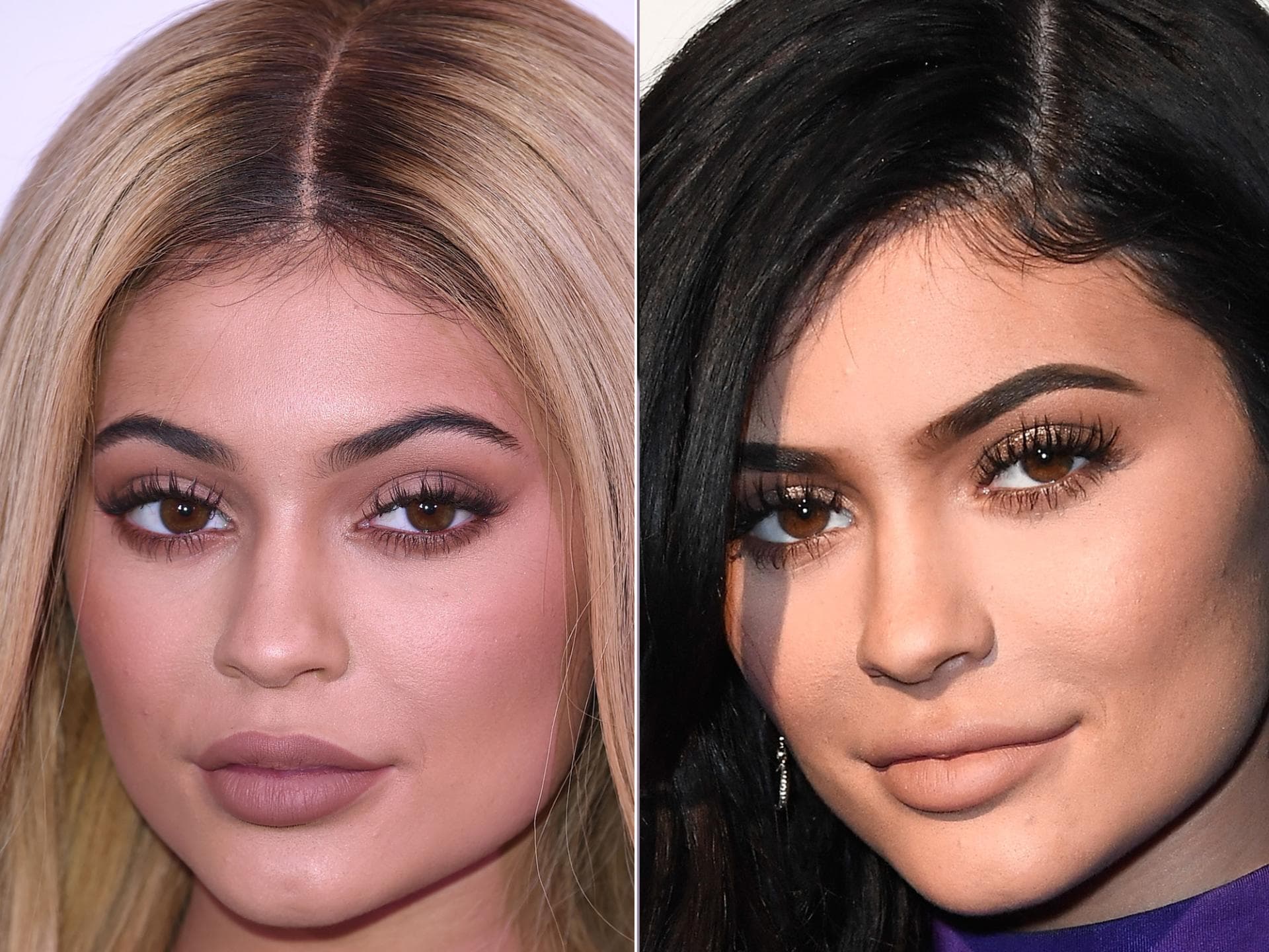 KYlie-Jenner-lippeninjektion KYlie-Jenner-lippeninjektion