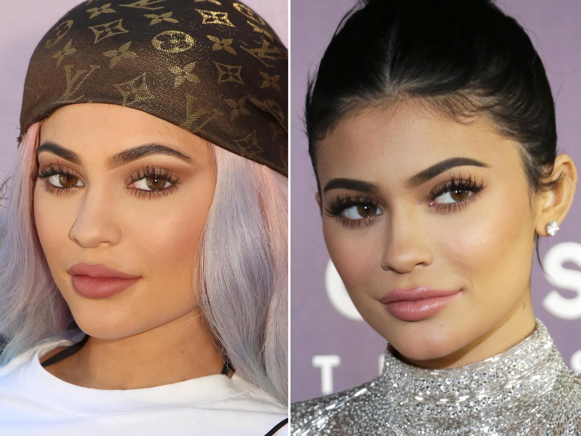 kylie-jenner-lippen-früher-heute kylie-jenner-lippen-früher-heute