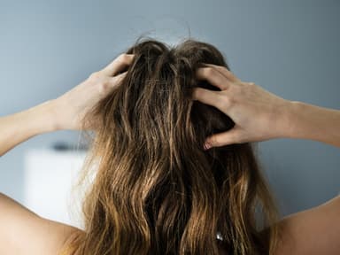 Schuppige Kopfhaut Frau