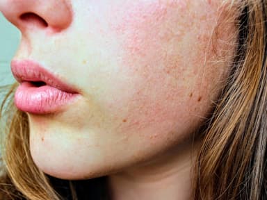 Gesicht und Lippen einer Frau