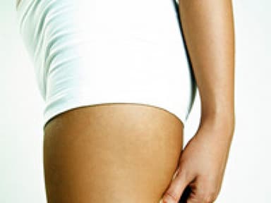10 verbreitete Cellulite-Mythen