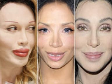 Botox: "A New Kind of Beauty"