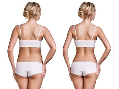 vorher-nachher-body