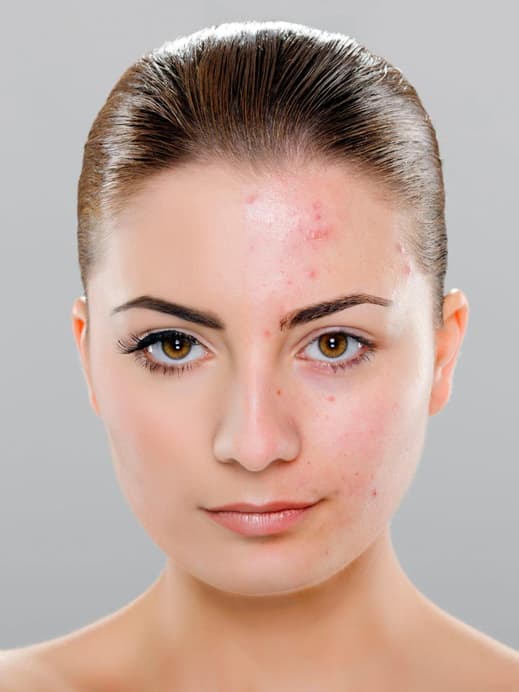 Hautprobleme und Ernährung