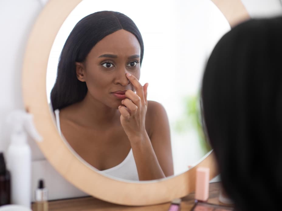 BeautyTipp 2023 5 Tricks gegen trockene Haut an der Nase