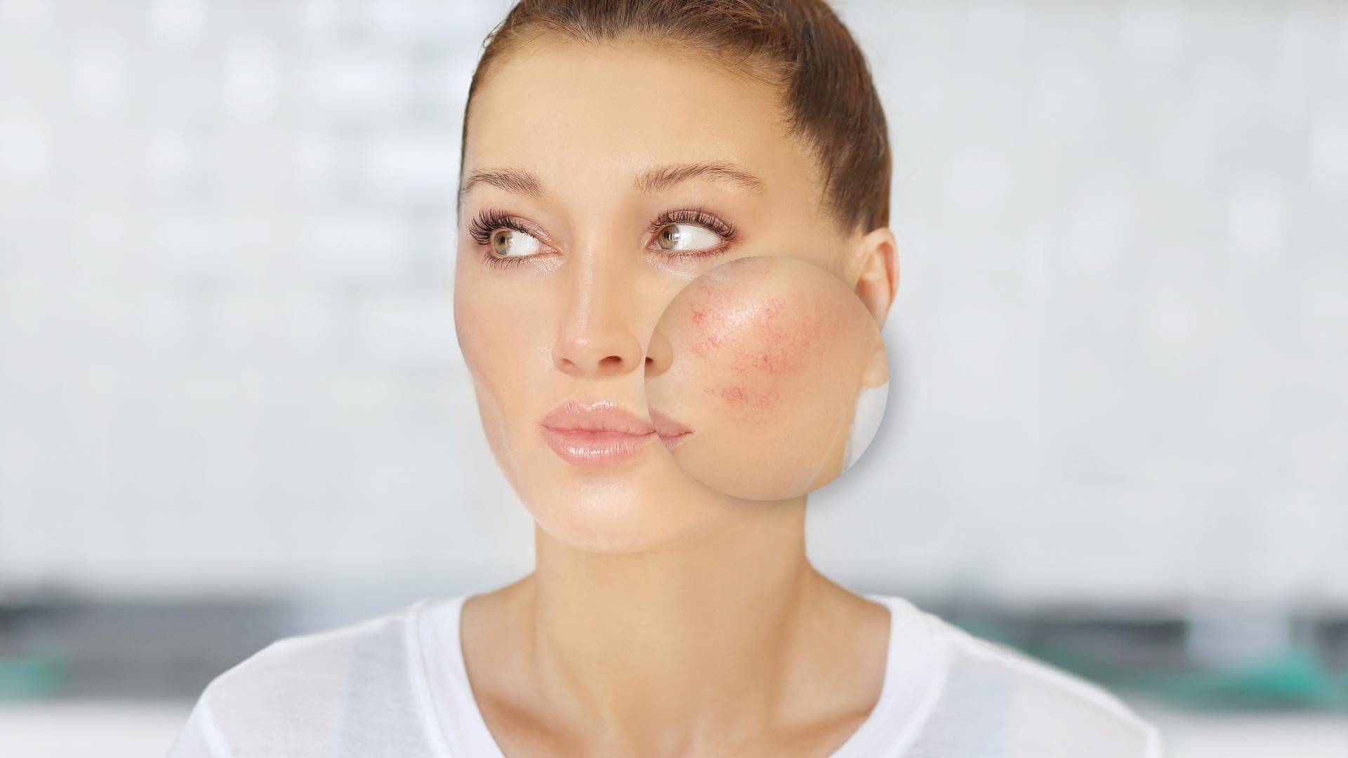 Dünne Haut Ursachen und wie man sie stärken kann