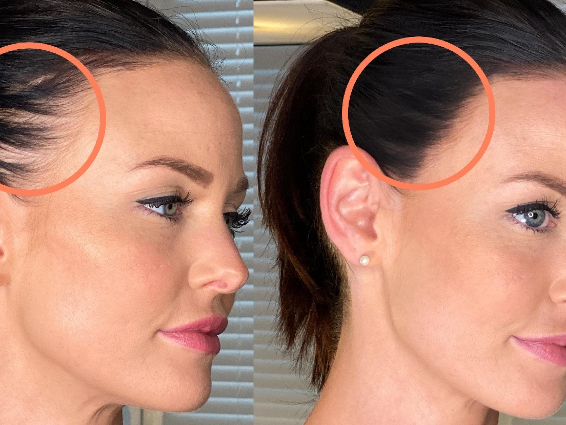 hilfe mein haar wird schutter