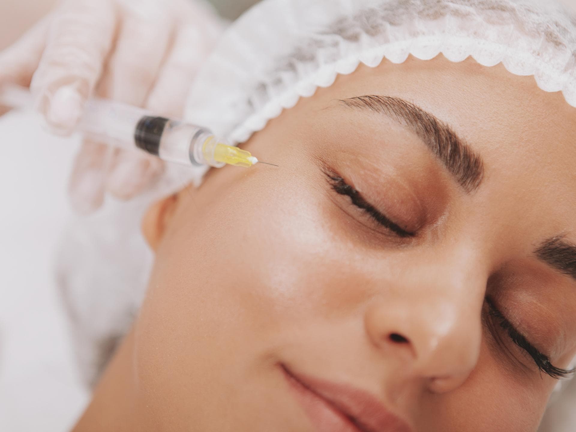 Augenringe unterspritzen: Alle Infos zum Eingriff